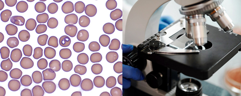 closeup image of a labratory specimen slide on the left side and closeup image of a microscope on the right